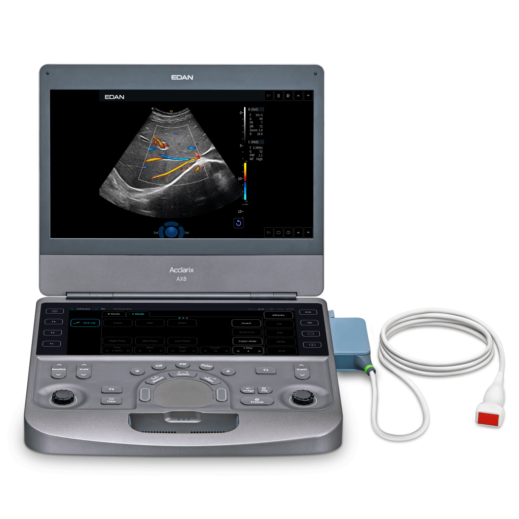 SISTEMA DE ULTRASONIDOS DE DIAGNOSTICO ACCLARIX AX8