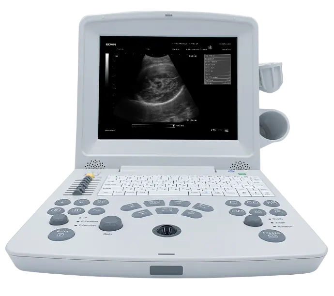 SISTEMA DE EXPLORACIÓN POR ULTRASONIDO DUS60