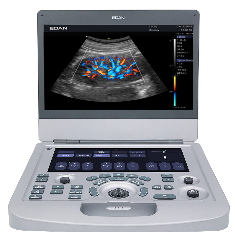 SISTEMA DE ULTRASONIDOS DE DIAGNOSTICO ACCLARIX AX3